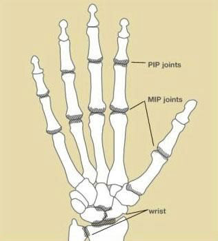 HandSurgery-3