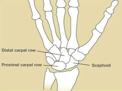 Sadik Plastic Surgery - Finger Lakes Plastic Surgeon - Scaphoid Fractures