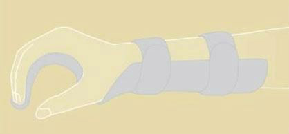 HandSurgery-8